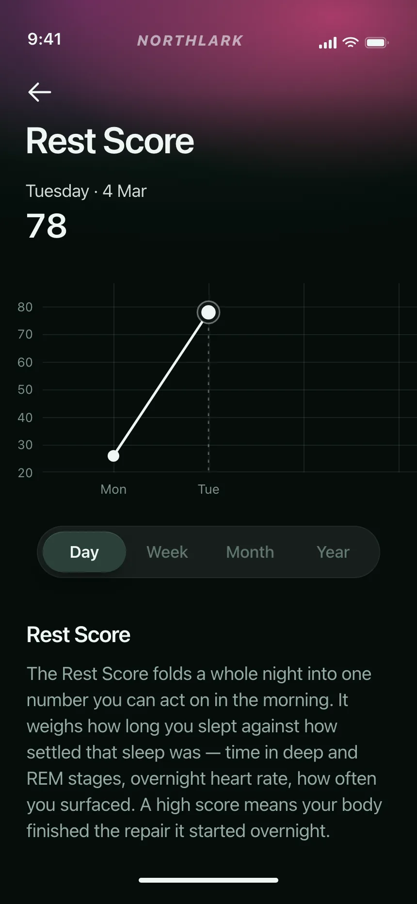 Charts